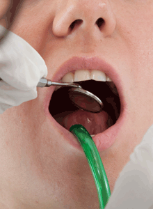 Mi élhet a fogkeféden?