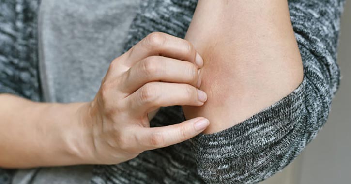 8 árulkodó jel, ami ritka allergiára utal
