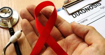Kérdések és válaszok a HIV-ről, AIDS-ről és más nemi úton terjedő betegségekről (STD)