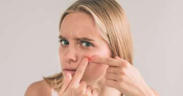 Pattanások: tények, tévhitek és megoldások