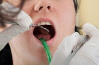 fogorvosnál