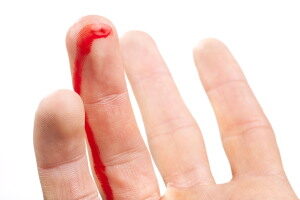 Vérző ujj