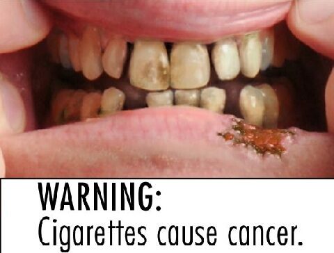 dohányzás, szájbetegség